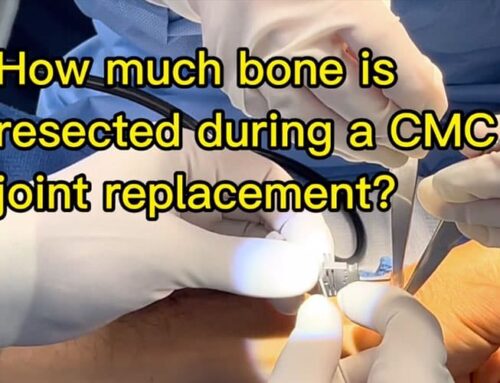 How much bone is resected during a CMC joint replacement?
