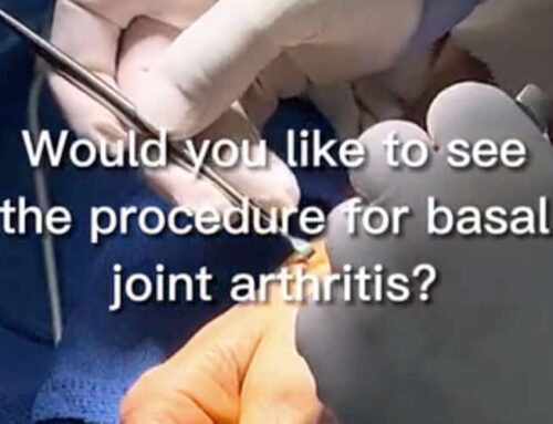 What procedure is needed for basal joint arthritis?